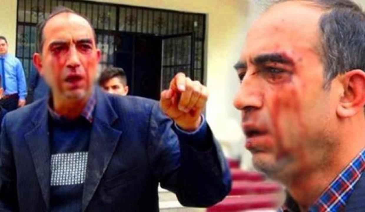Kantin ihalesinde ortalık savaş alanına döndü