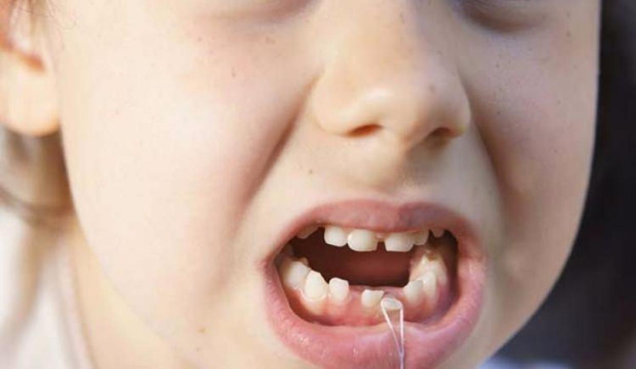 sut dislerini atmayin anne cocuk haberleri