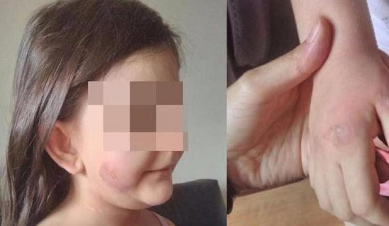 Çocuğuna sevgilisi ile birlikte işkence yaptı!
