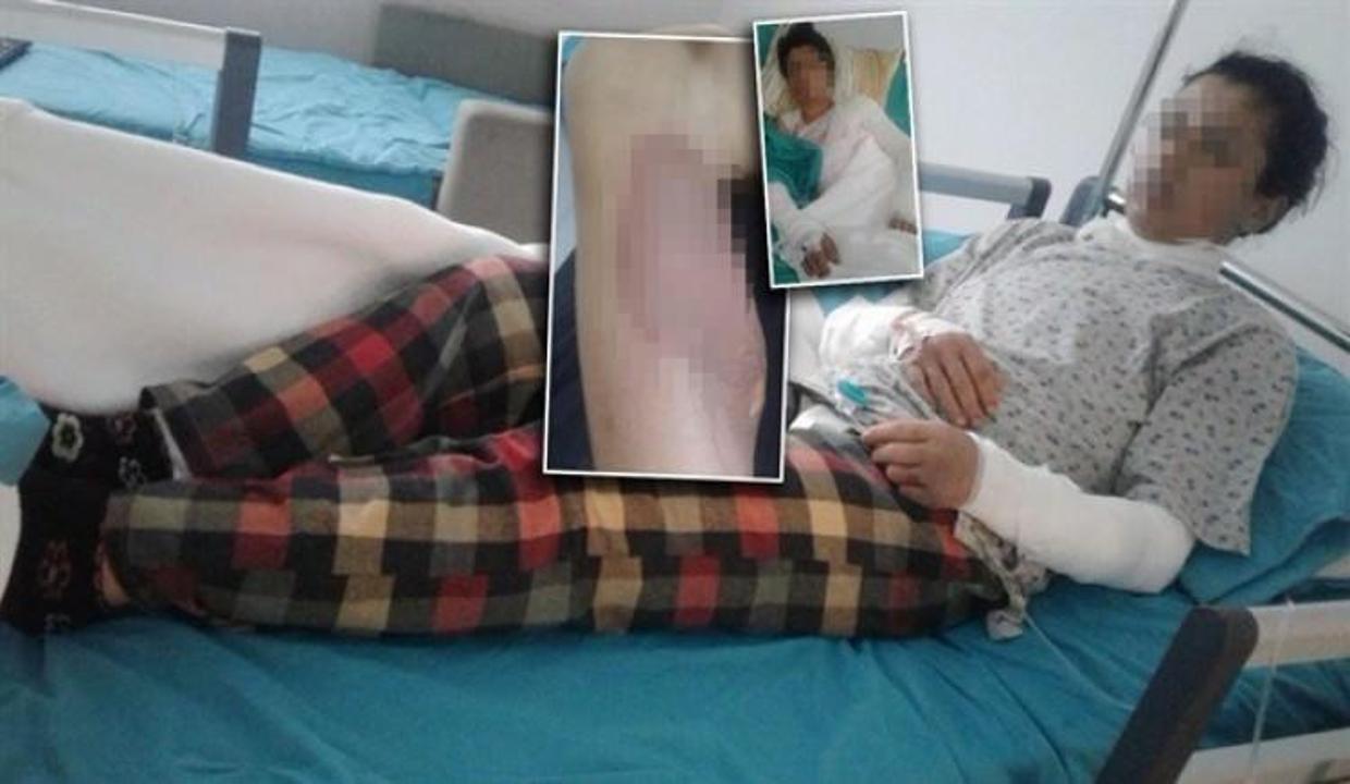 Koca vahşeti: Özgecan gibi acı çektire çektire...