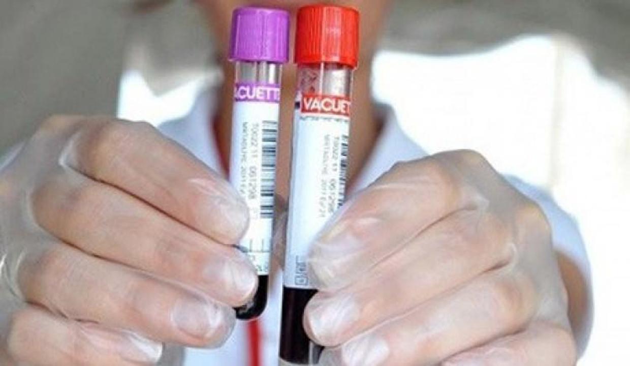 Tartışma başladı: Nikah öncesi zorunlu olsun!