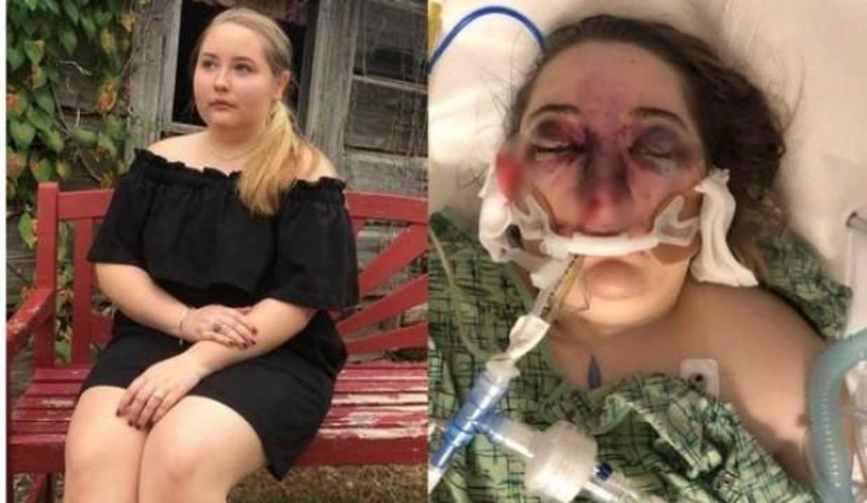 Gizemli hastalığını doktorlar bile çözemiyor
