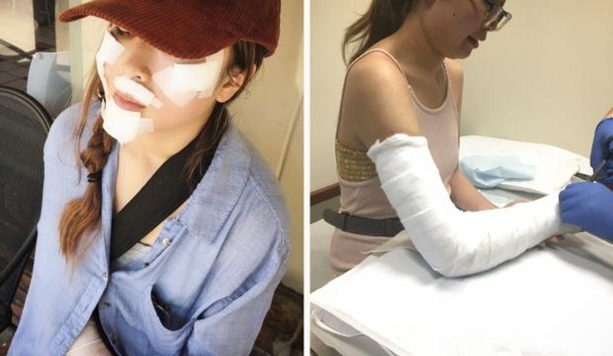 bisikletten dusup kolunu kirdi eve gelen faturayi gorunce soke oldu dunya haberleri bisikletten dusup kolunu kirdi eve gelen faturayi gorunce soke oldu dunya haberleri