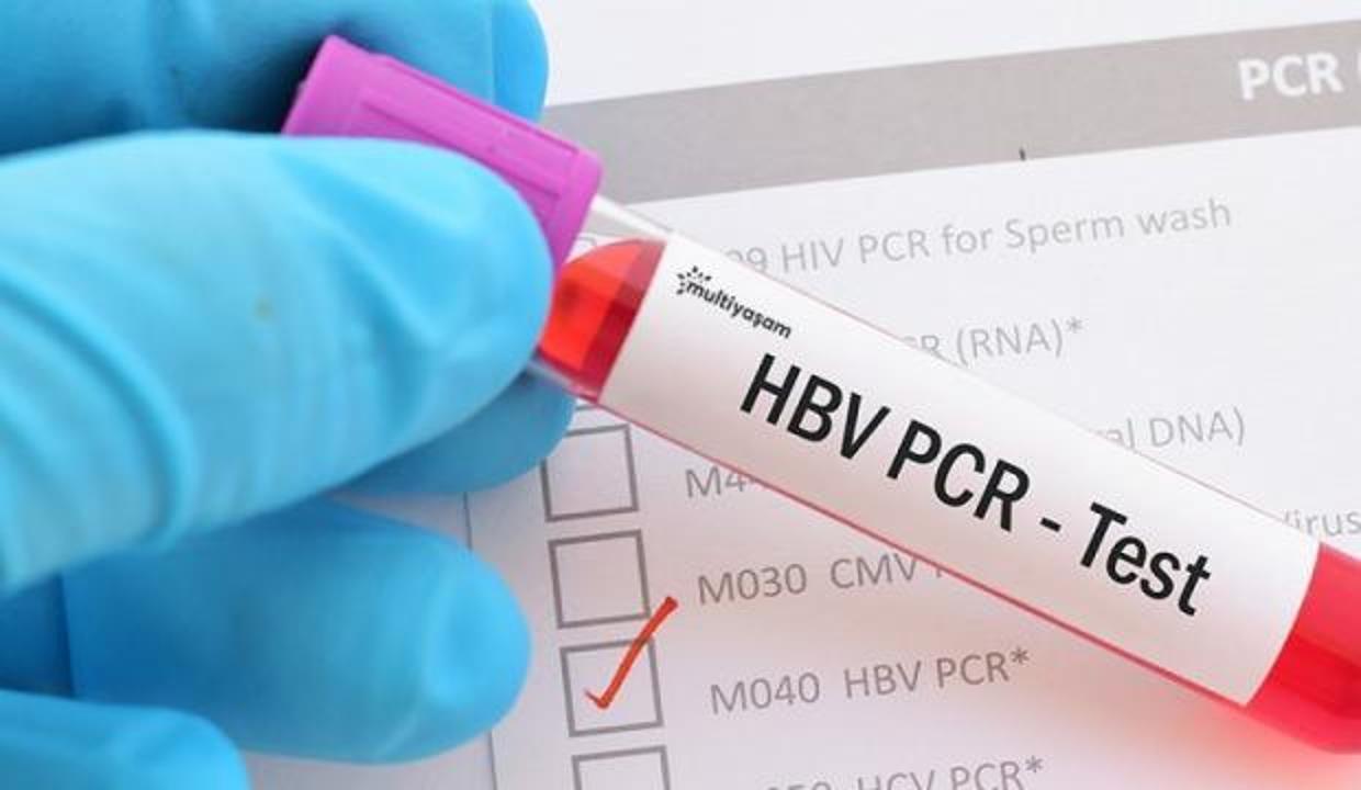 Yurt dışına çıkışlarda PCR testi istenen vatandaşlar için test ücreti belli oldu