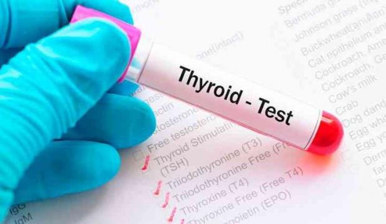 TSH yüksekliği nedir neden olur? Tiroid uyarıcı hormon belirtileri ve tedavisi