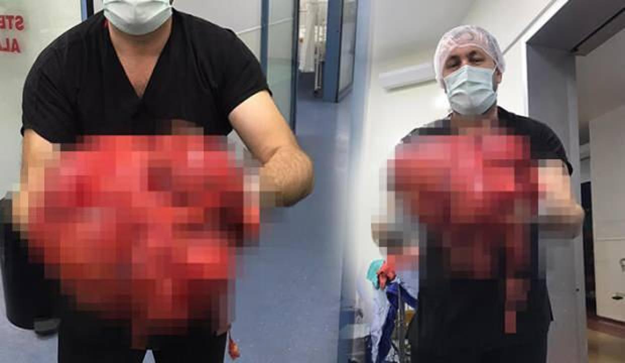 Zonguldak'ta karnından 14 kilogramlık kitle çıkarıldı
