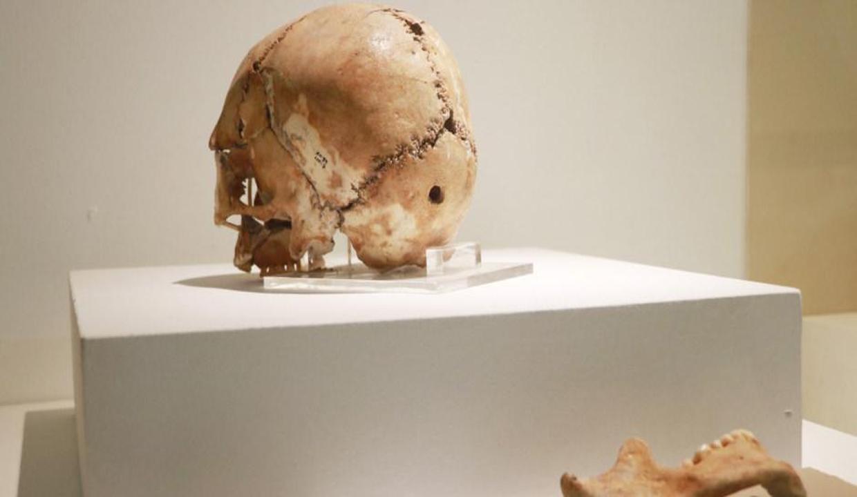 Dünyadaki ilk beyin ameliyatının yapıldığı Aşıklı Höyük tarihe ışık tutuyor
