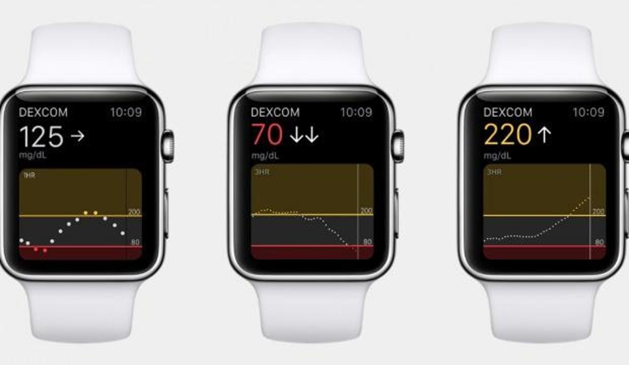 Apple Watch kan şekerini de ölçecek