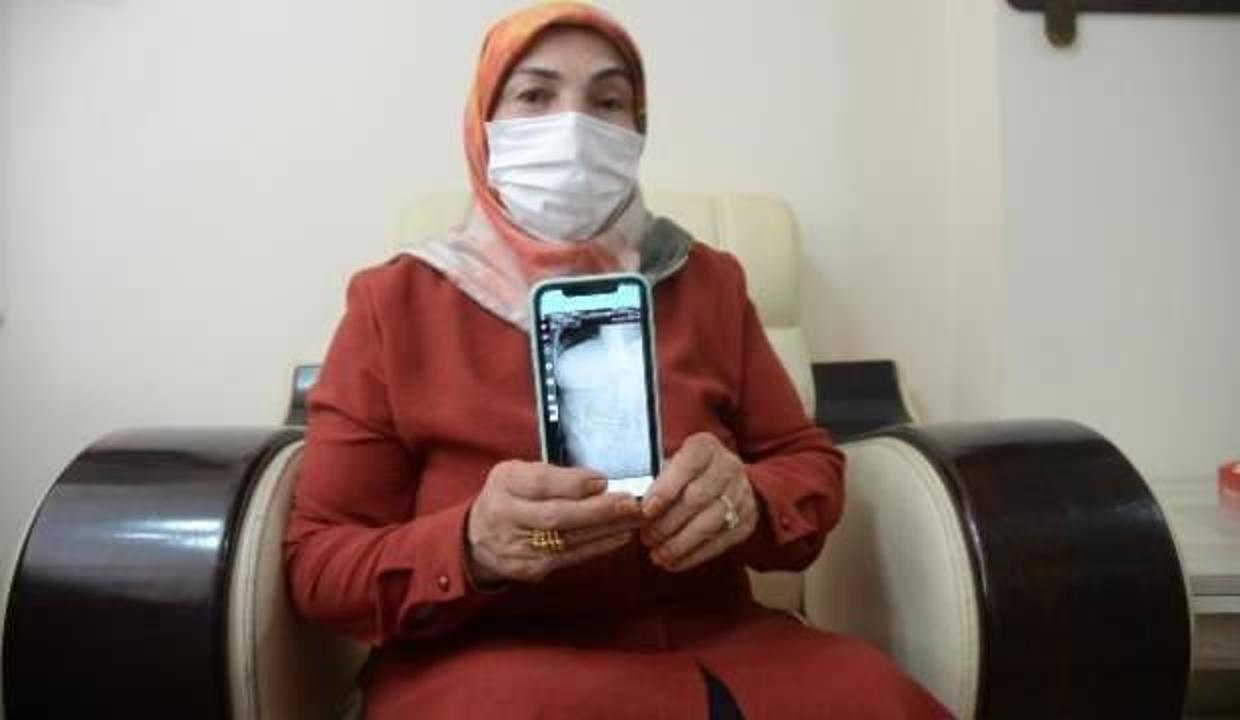 Ameliyat oldu ama ağrıları dinmedi, şoke eden gerçeği tam 2 ay sonra öğrendi!