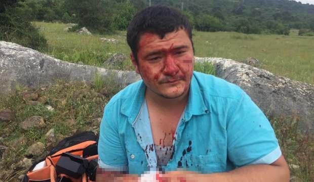 Anadolu Yayıncılar Derneği'nden İHA muhabirine yapılan saldırıya kınama