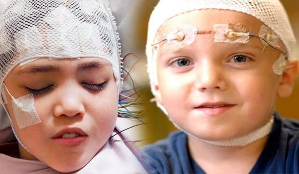 Çocuklarda epilepsi hastalığına dikkat!