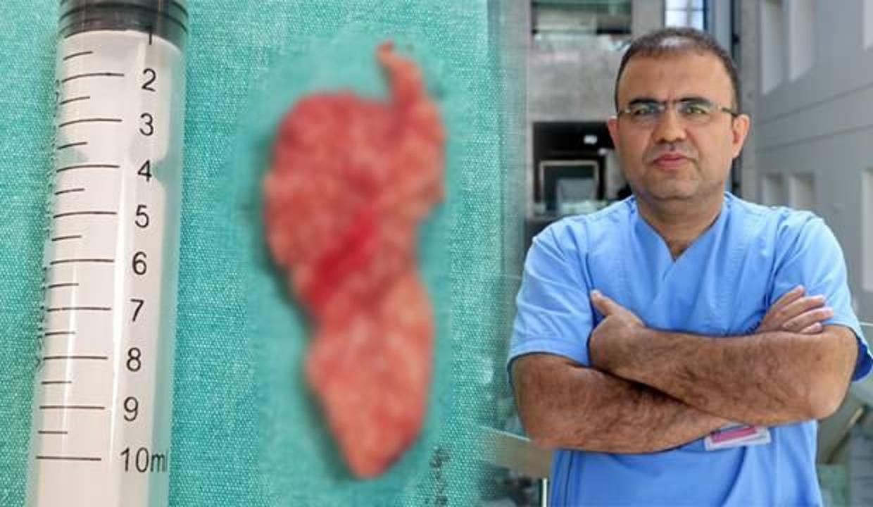 Nefes alamıyorum diyerek gitti! Burnundan 10 santimlik tümör alındı