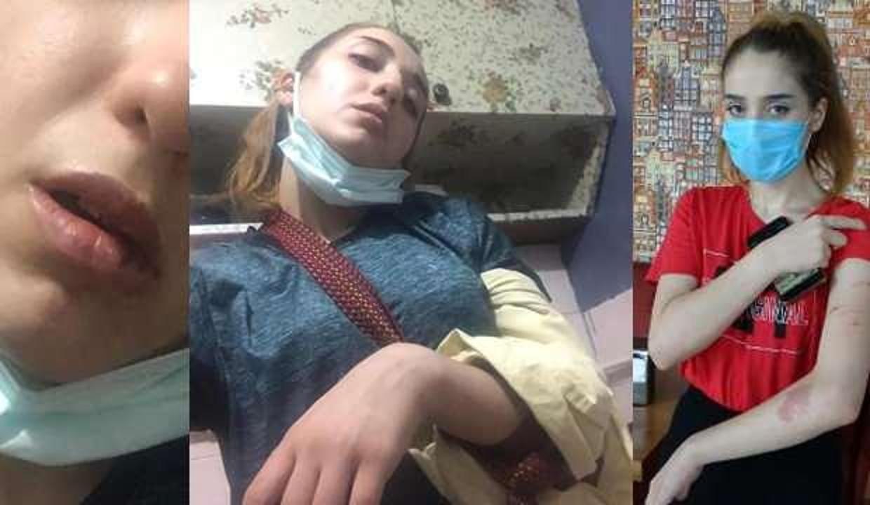 Sultangazi'de genç kadının yardım çığlığı