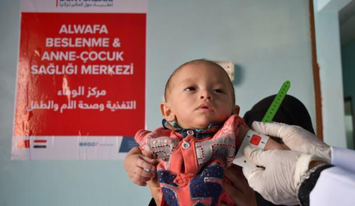 Yeryüzü Doktorları'nın 2021 Yemen raporu: Açılıkla mücadele