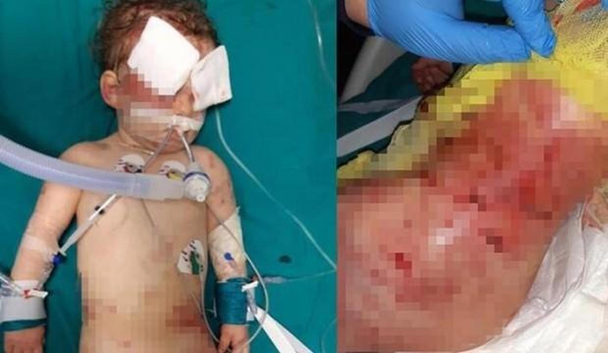 Anne �köpek saldırısı� dedi doktor inanmayınca&hellip; GÜNCEL Haberleri