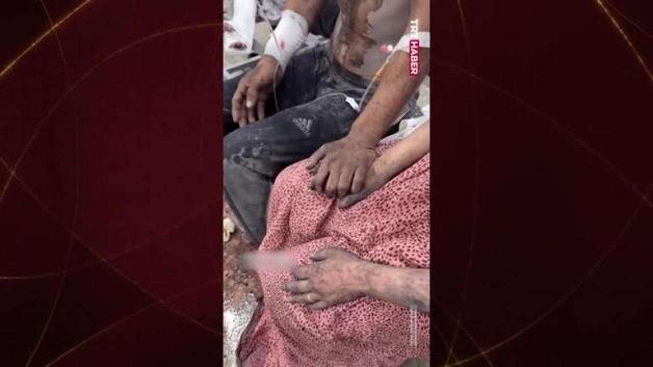 İsrail’in saldırılarının ortasında el ele hayatta kalma mücadelesi veren aile yürekleri yaktı