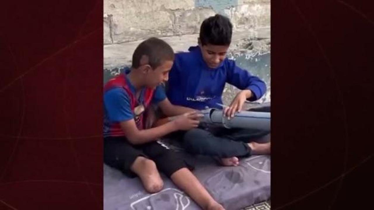 Bir lokma sevinç, bir ömürlük acı: Gazze’de bir çocuk, kendi protezini yaptı