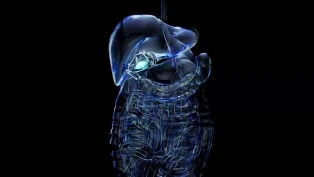 Hazımsızlık deyip geçmeyin: Altında safra kesesi taşı olabilir