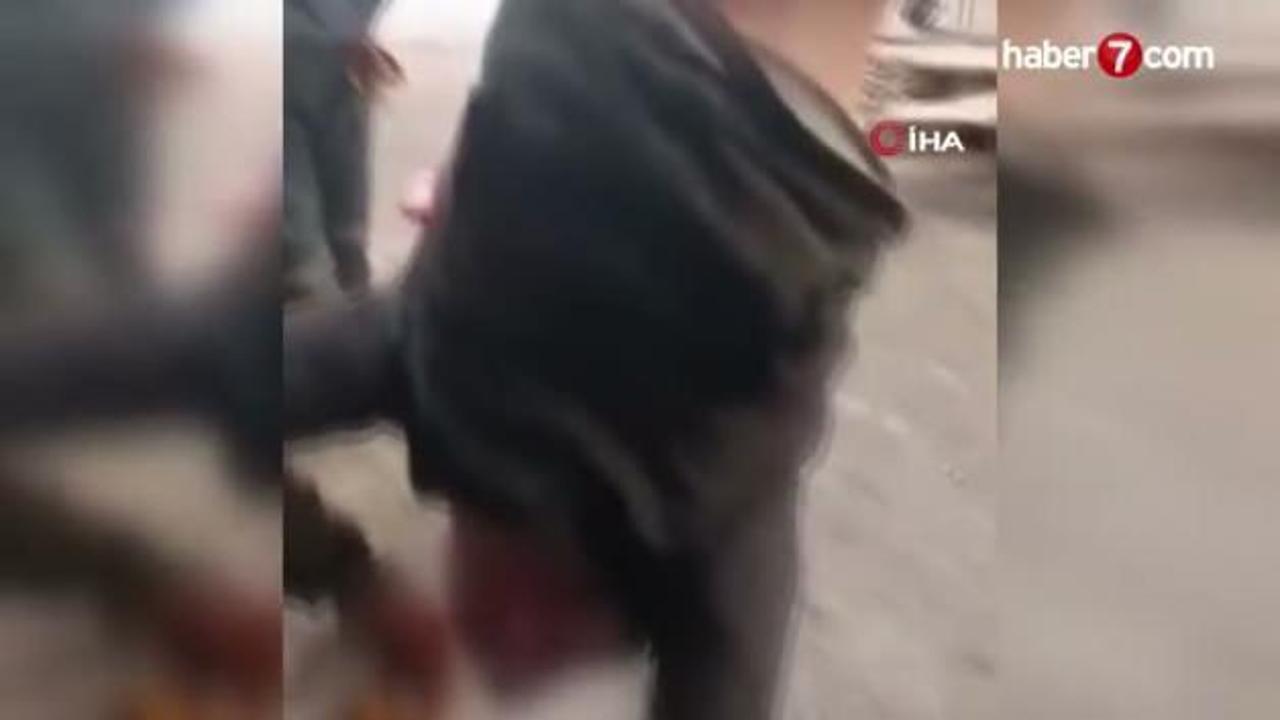 Yer: Ankara! Zihinsel engelli şahsı ayağından bağlayıp vince astılar