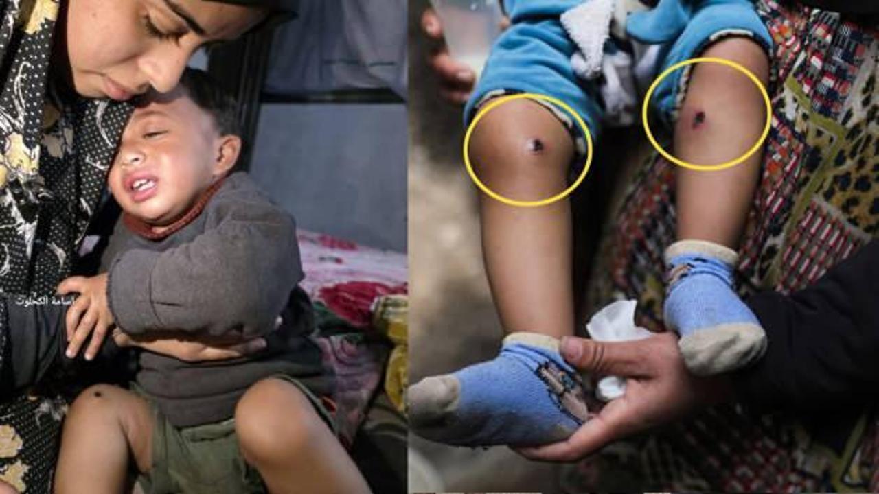 İsrail askerlerinden babayı itirafa zorlamak için 1,5 yaşındaki bebeğe işkence