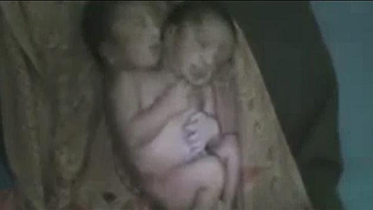 &Ccedil;ift başlı bebek şoke etti!