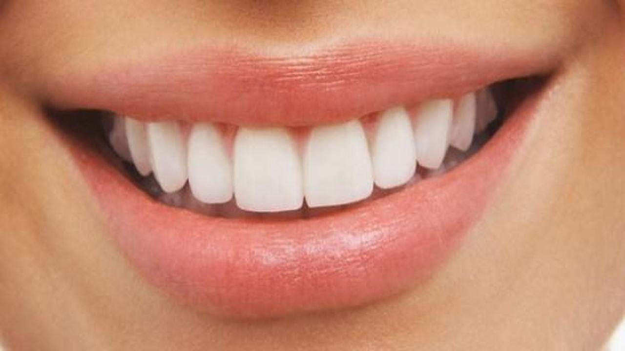 Diş beyazlatma işlemi diş sağlığı için zararlı mı?