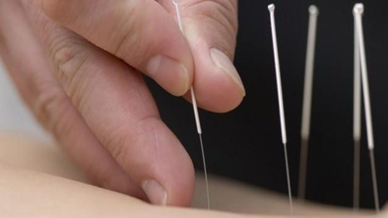 Akupunktur ile hamilelik ihtimali artırılabilir