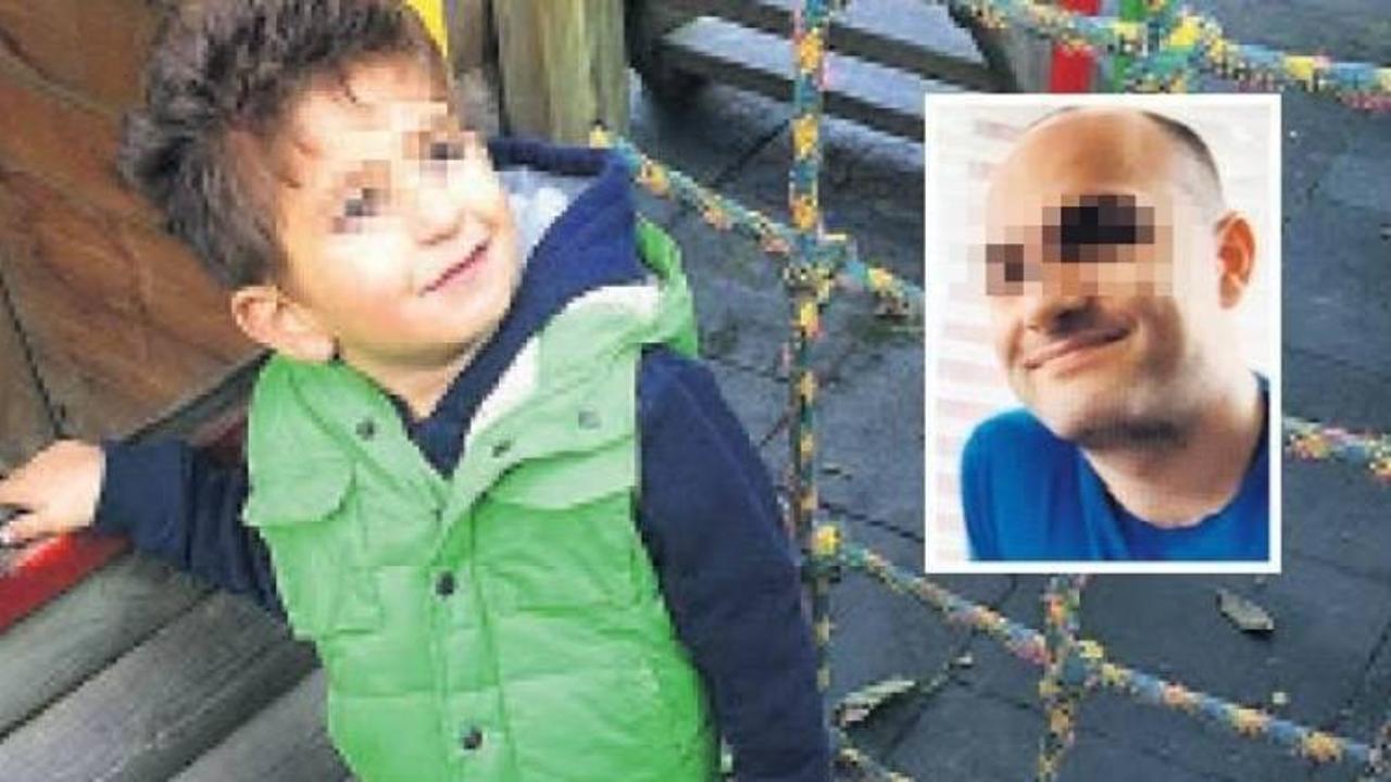 Y&uuml;z&uuml; asitle yakılan &ccedil;ocuk artık g&ouml;rm&uuml;yor