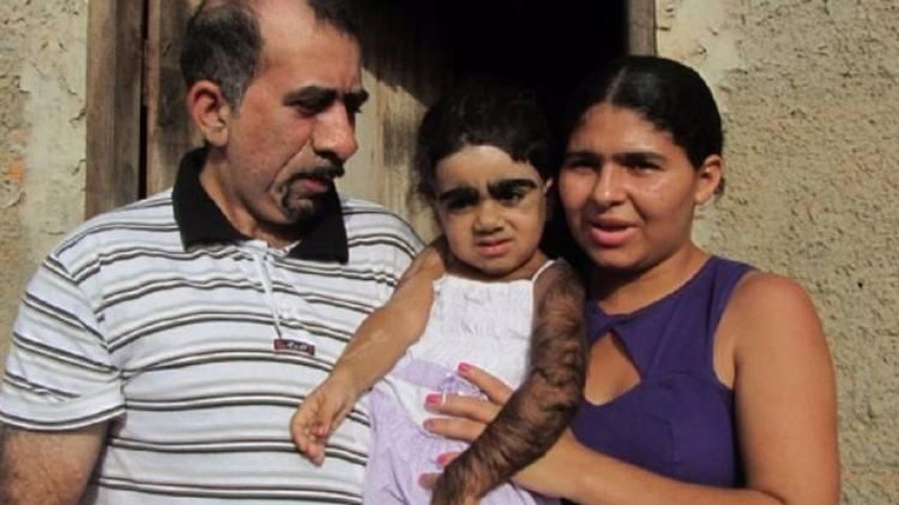 kızgın küçük adam sendromu