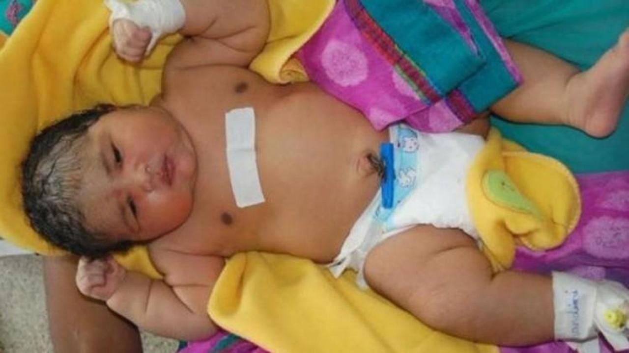 Dünyanın en ağır bebeğini doğurdu