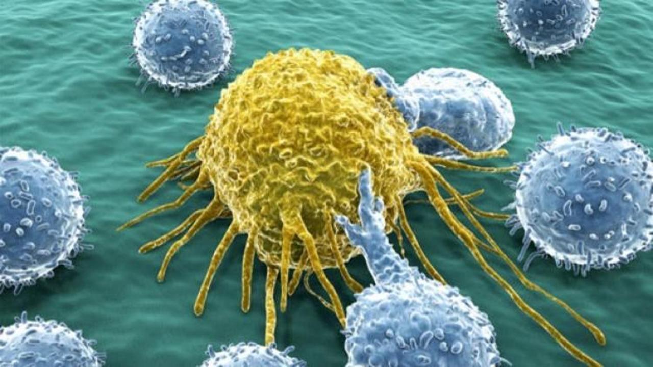 En sık karşılaşılan 5. tür kanser
