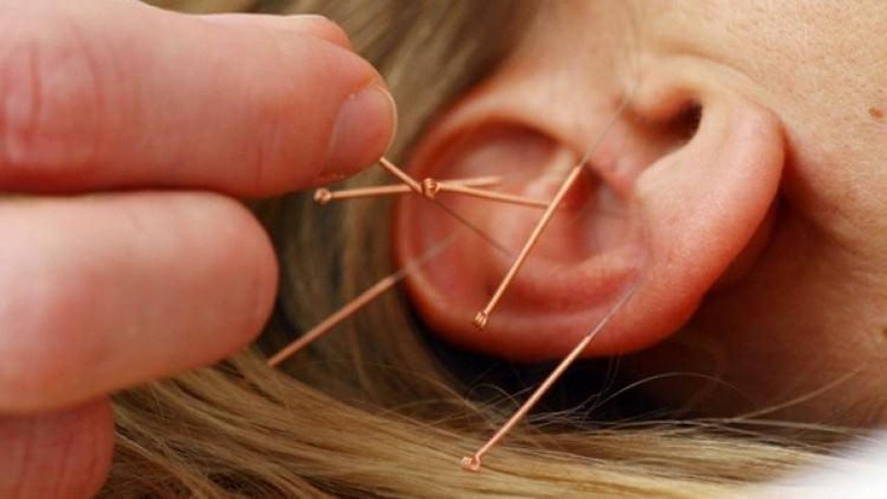 Akupunktur ve oruç
