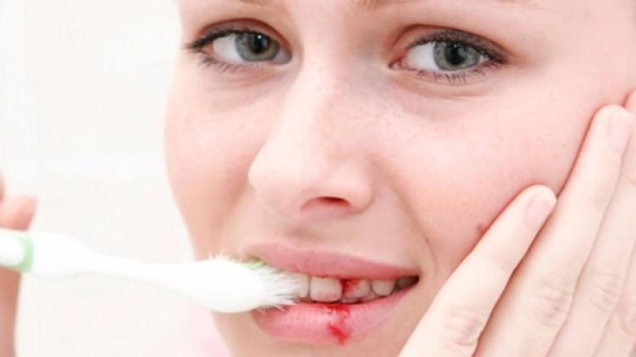 Diş eti hastalıkları erken doğuma neden olabiliyor