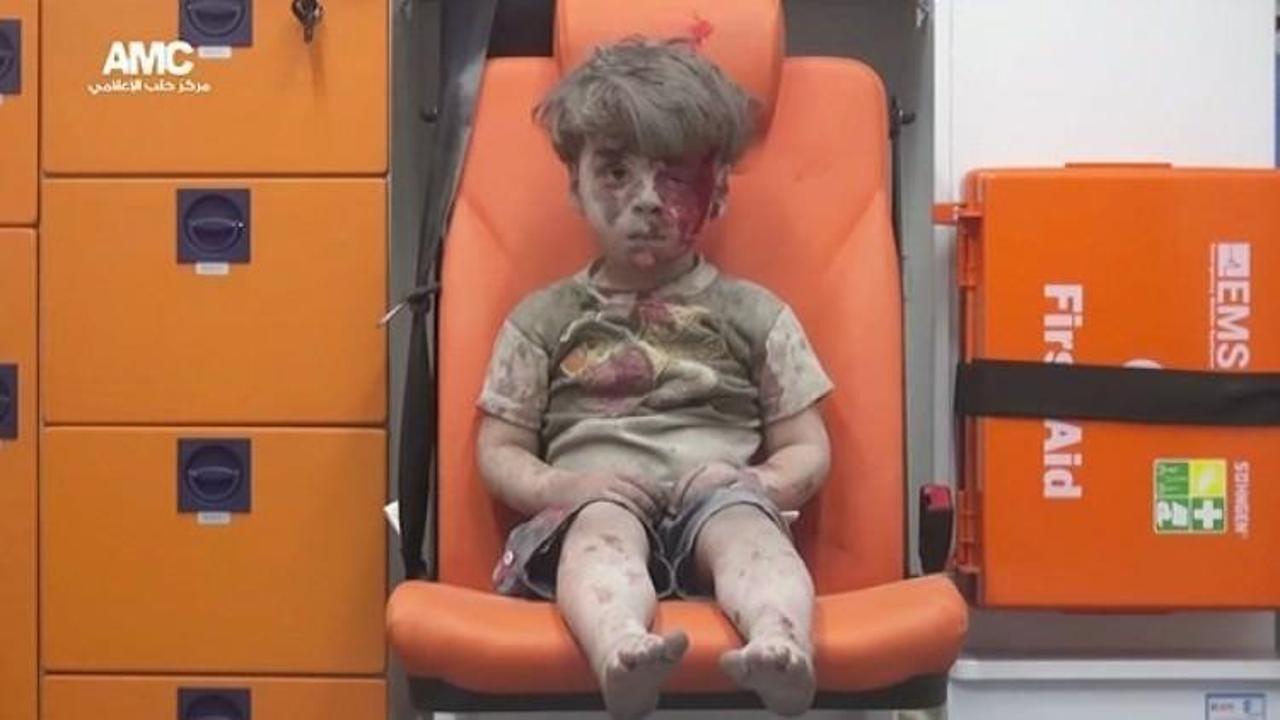 Halep'te Ümran gibi 100 bin çocuk var