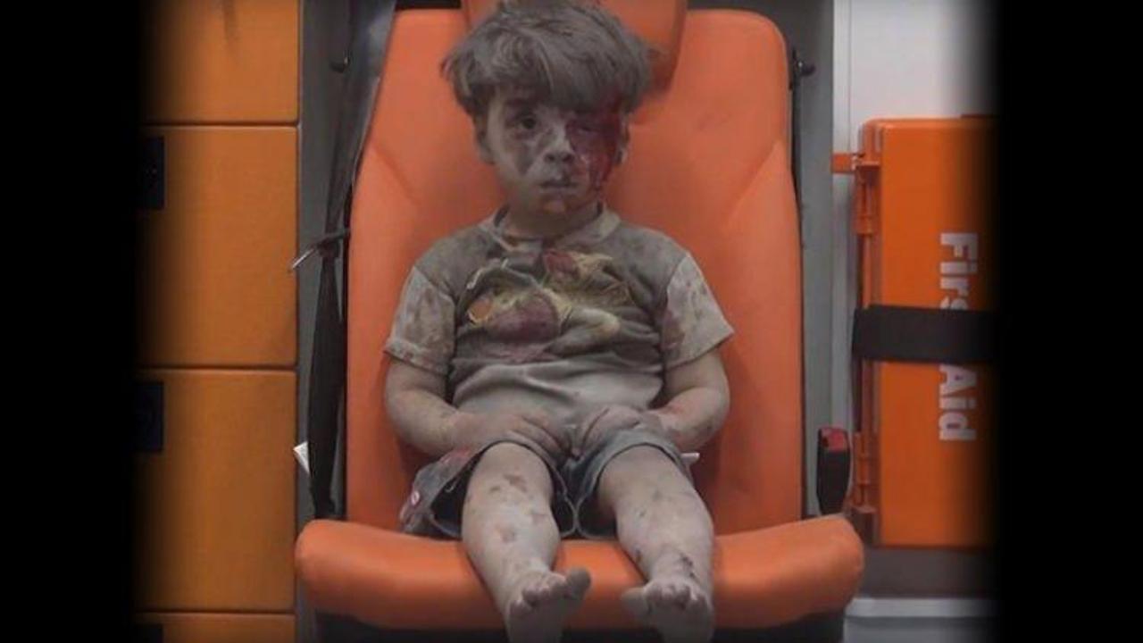 İnsanlığın yeni utancı 'Suriyeli Ümran' haberleri! - Halepli Ümran spikeri ağlattı! - BM Umran'dan sonra...