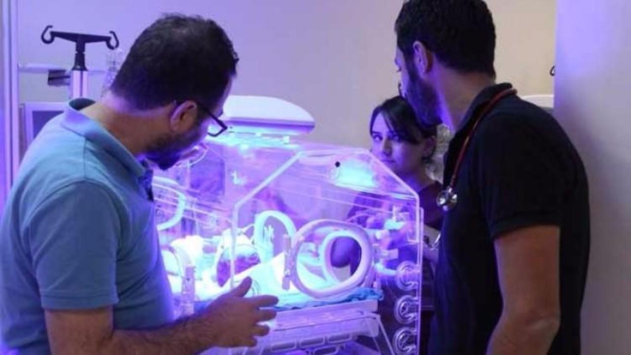 Siirt'te 'yılan bebek' d&uuml;nyaya geldi