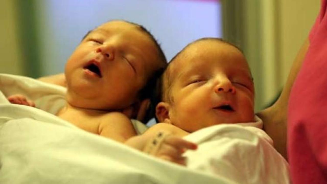 Hatay'da yapışık ikizler doğdu