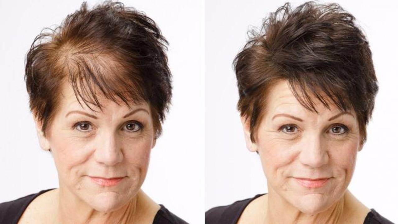 Saçı kazıtmak dökülmeyi önler mi?