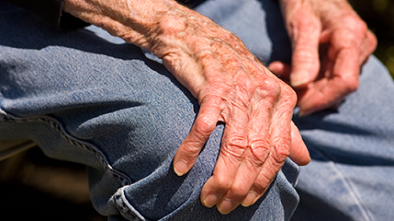 Romatizmada erken tanı eklem yıkımını &ouml;nl&uuml;yor