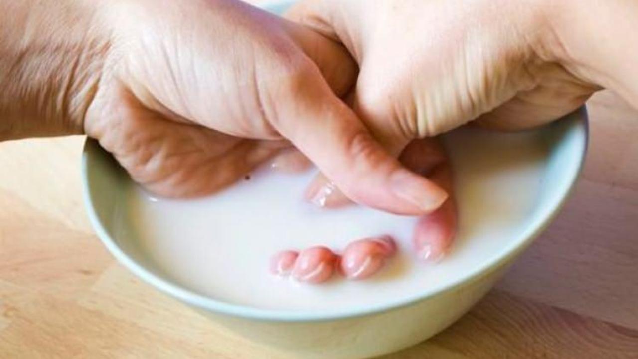 Eldeki biber acısı nasıl ge&ccedil;er?