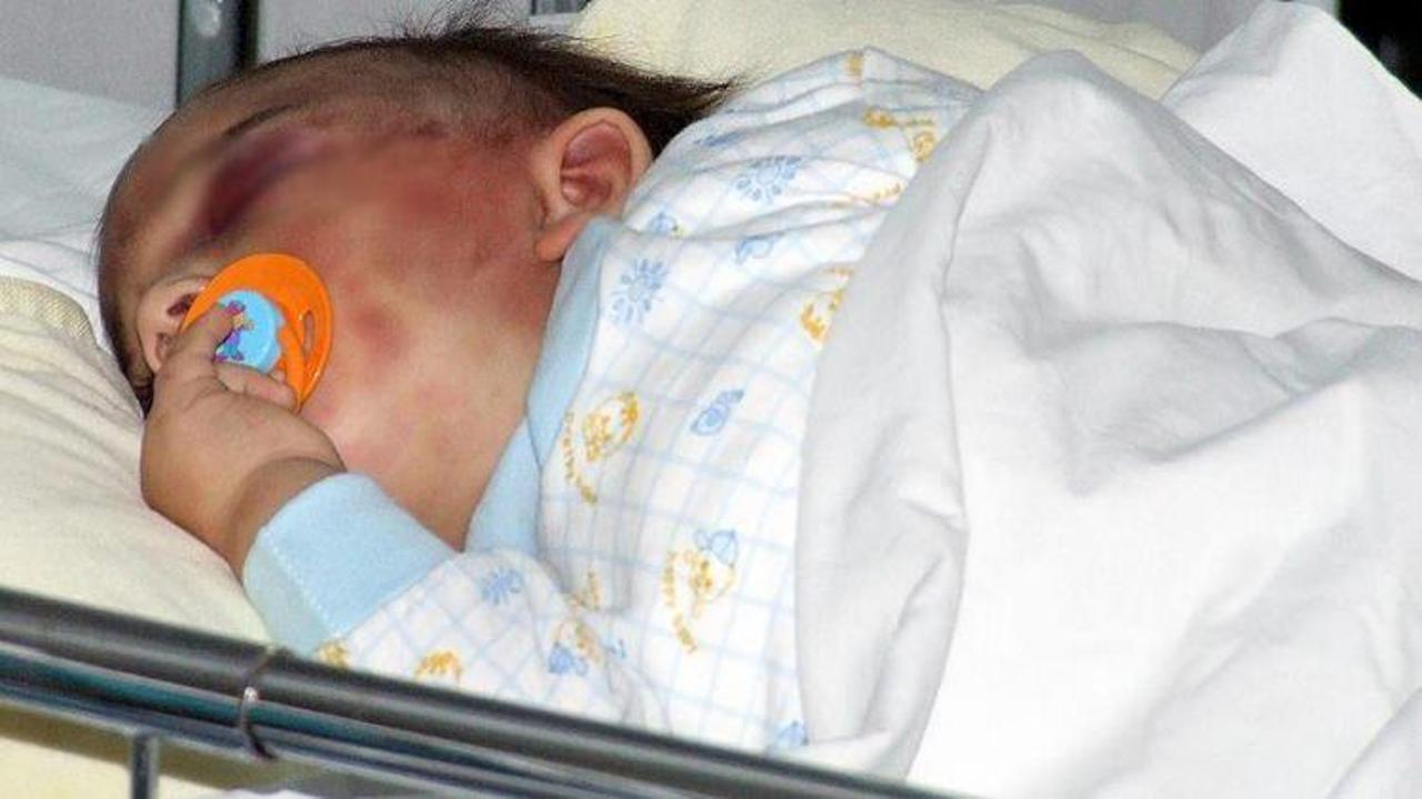 Bebeği şiddetle sarsmak ölüme neden olabilir