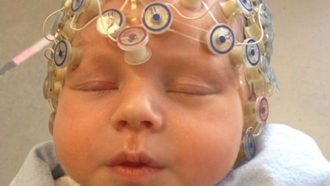 Bebeklerin beyni yetişkinlere göre daha çok amaçlı