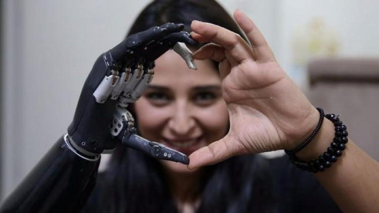 Travmalar yıldırmadı, "Revo"yla hayata tutundu!