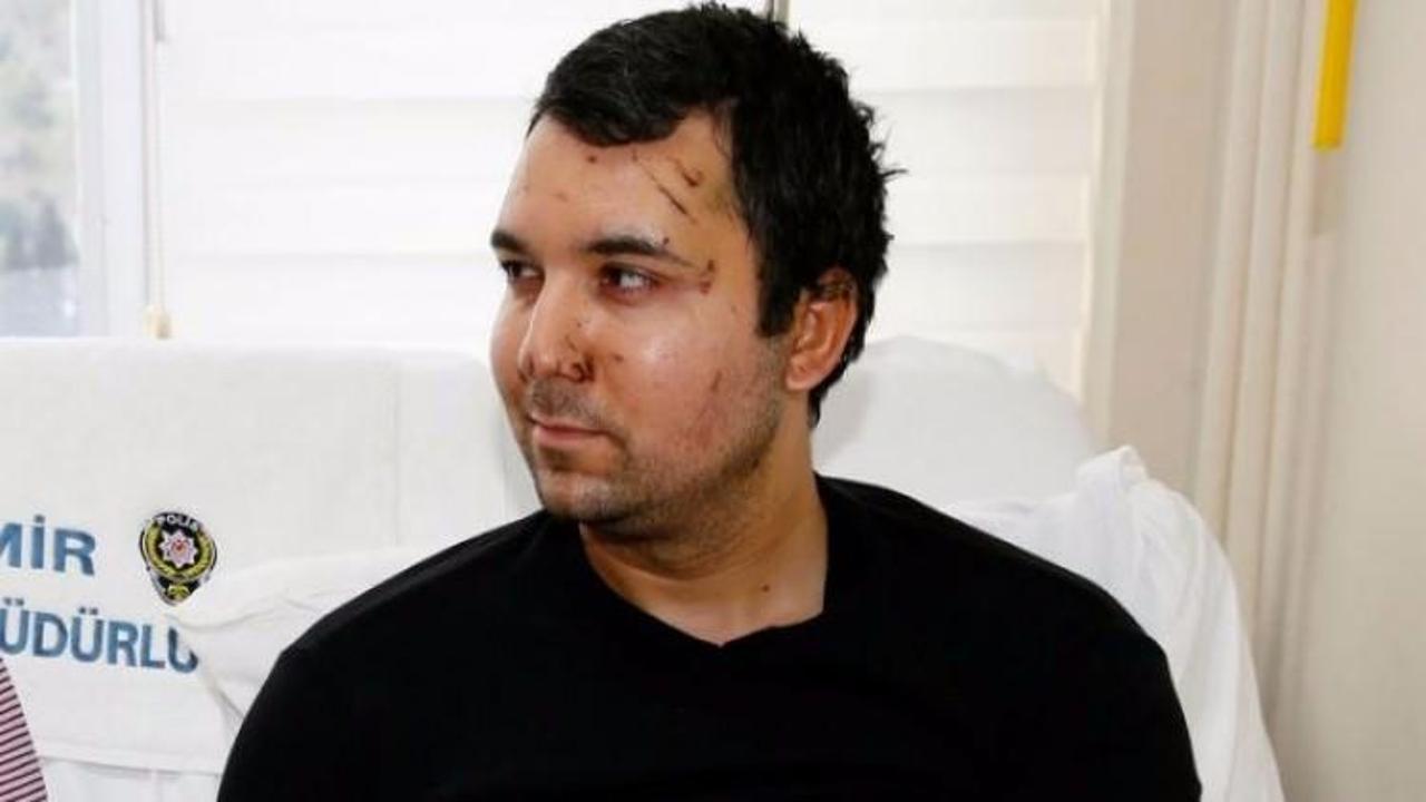 Yaralı polis &ccedil;atışma anını anlattı! 