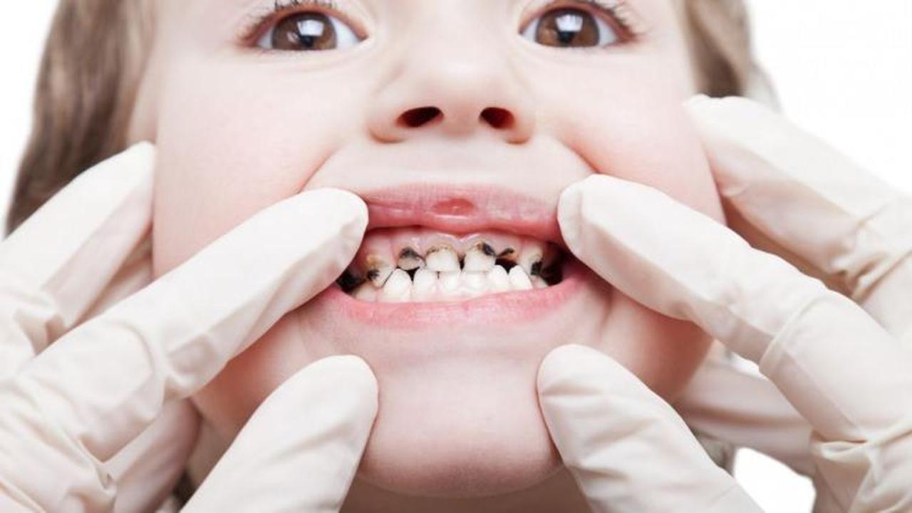 Çocuğunuzun diş bakımını sömestrda yaptırın!