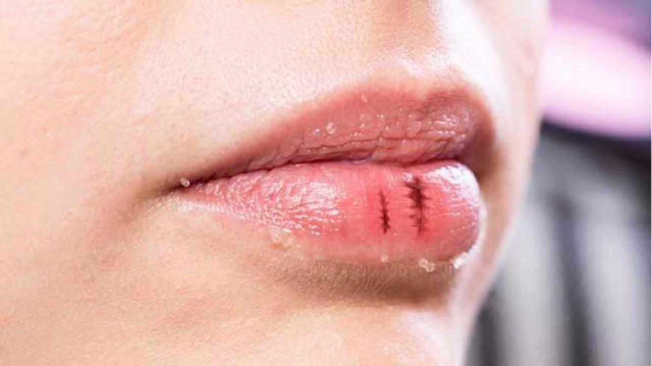 4 adımda sağlıklı dudaklara kavuşun