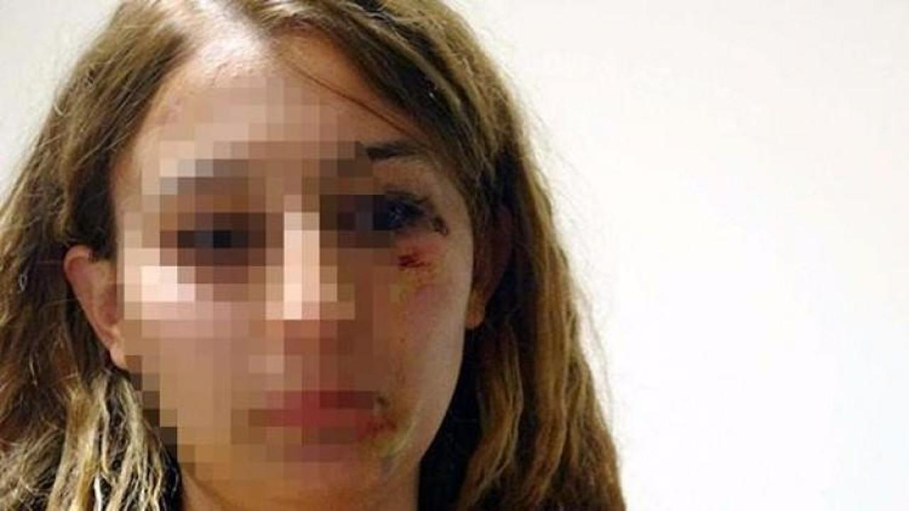 Mardin'de kuaför kadın polisi dövdü!