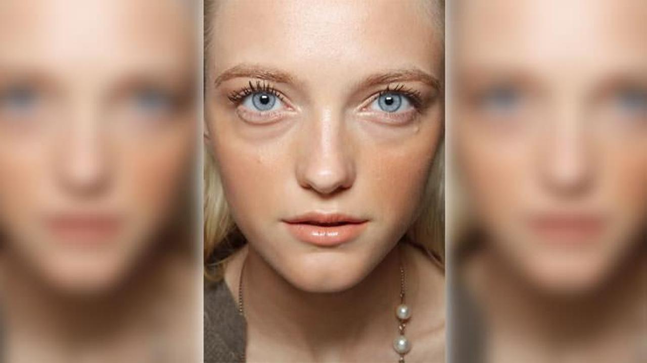 G&ouml;z altı torbaları neden olur?