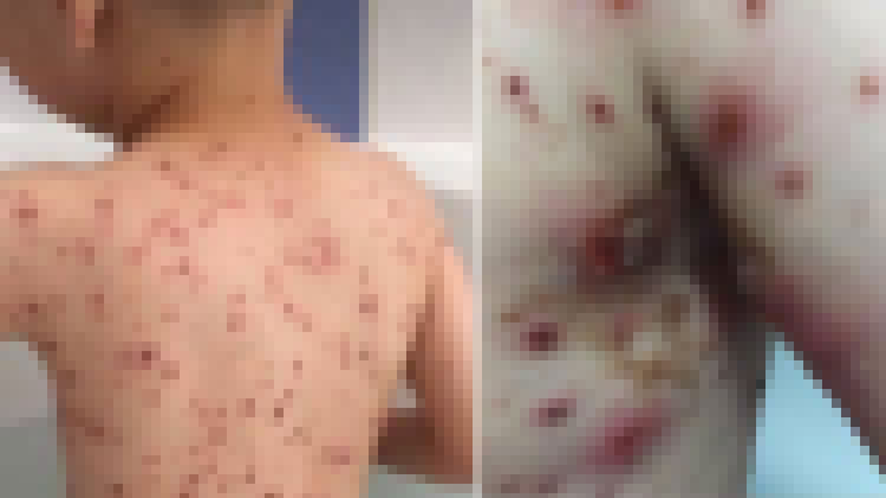 Yanlış teşhisle hayatı kararıyordu!