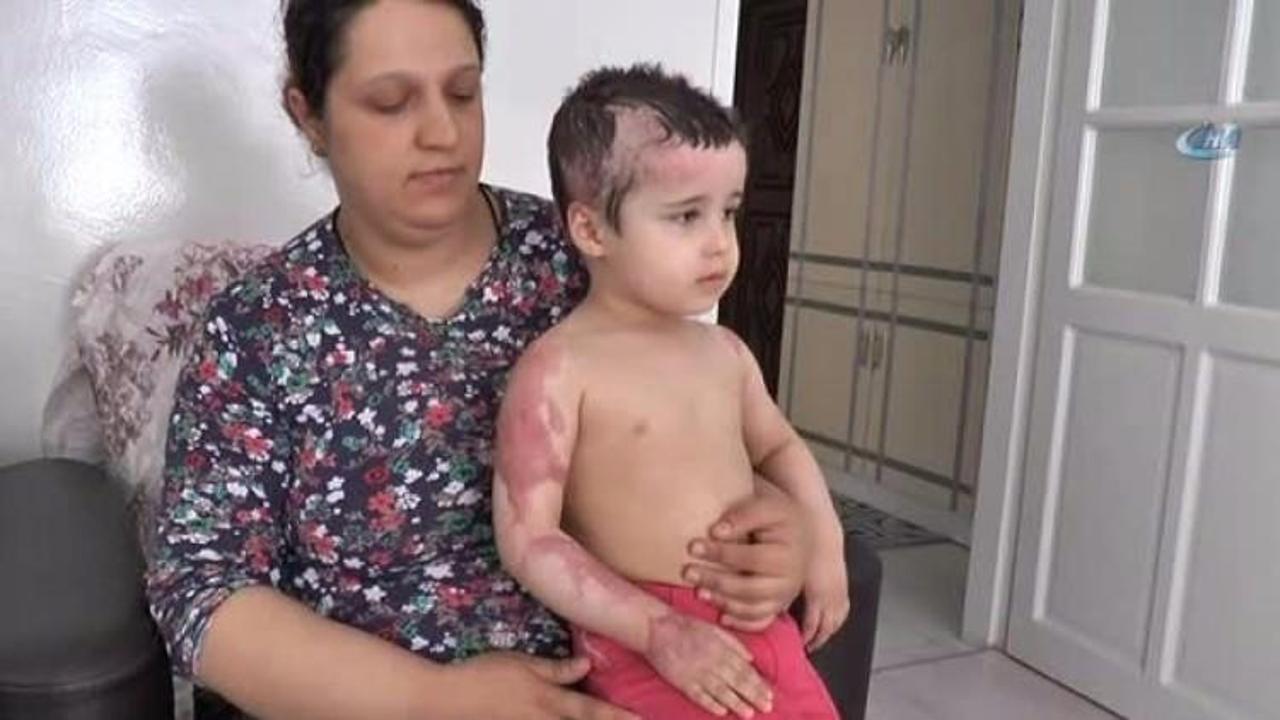 Komşuya emanet ettiği kızı bu hale geldi!